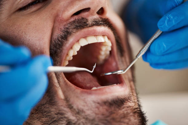 Best Emergency Treatment for Dental Infections or Abscesses in Delta, CO